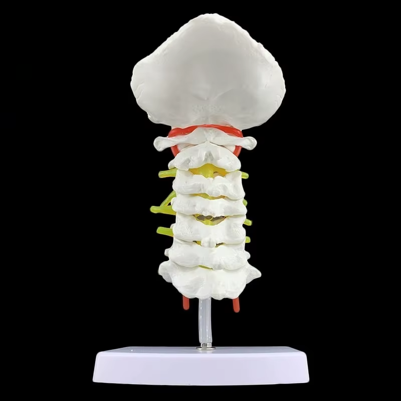 Modèle anatomique humain modèle de vertèbre cervicale colonne cervicale avec artère du cou disque d'os occipital et modèle nerveux